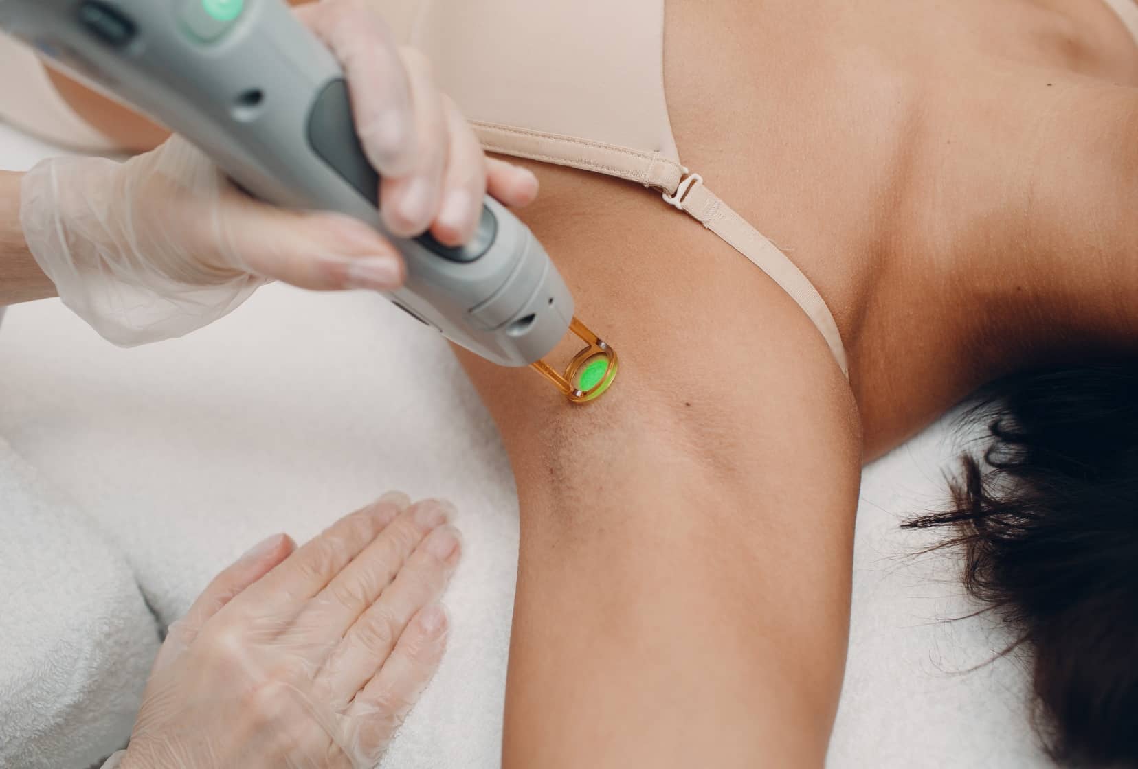 Que faire avant une l’épilation laser | Skin Marceau | Paris 16