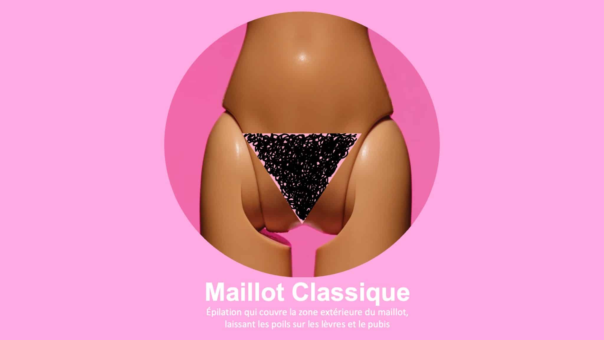 epilation maillot classique photo skin marceau paris