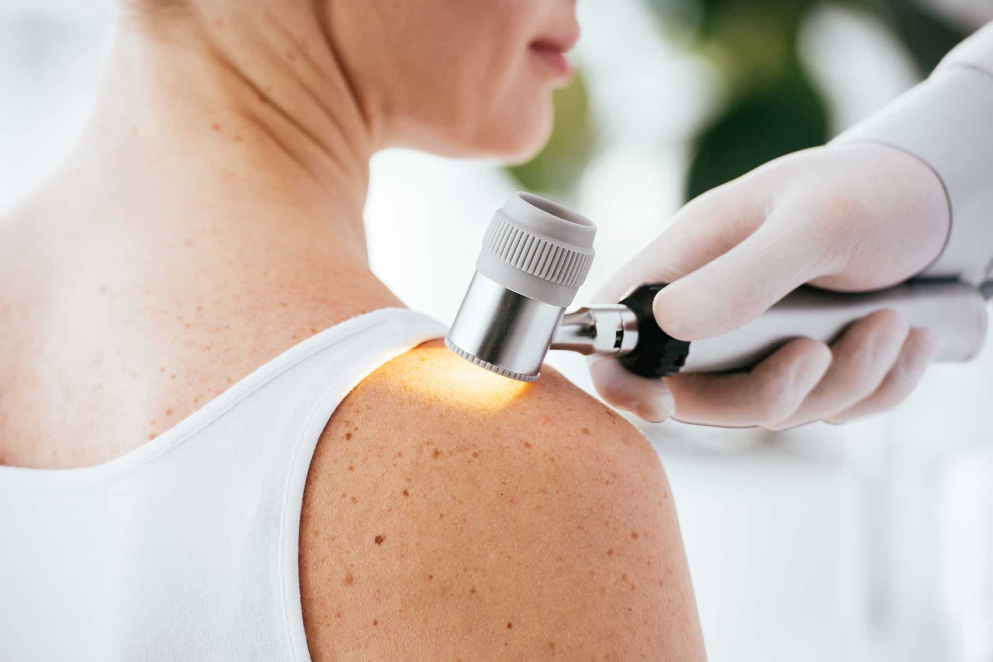 grain-de-beaute-cancerigene